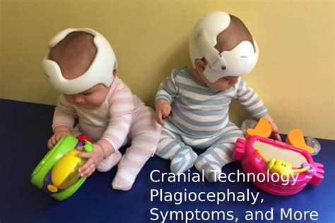 Cranial technology - Cranial Technologies offers free consultations and treatment for plagiocephaly, a condition where a baby develops a flat spot on the back of their head. Learn about the DOC Band, a custom-made helmet that reshapes your baby's head, and find a clinic …